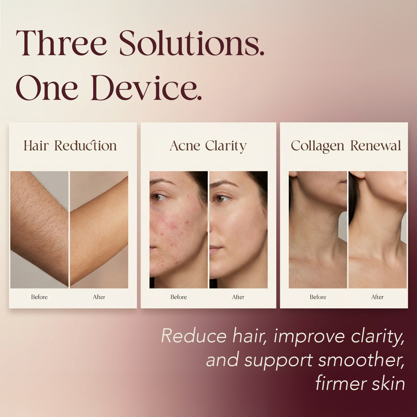 Elara - IPL Laser Hair Removal Device