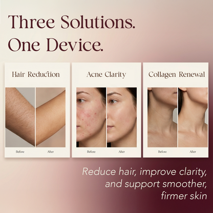 Elara - IPL Laser Hair Removal Device